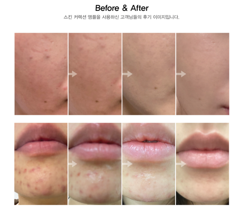 Hikstain Ampoule 28days 4Week Solution Ampoule Cream Kit Skin Correction Ampoule